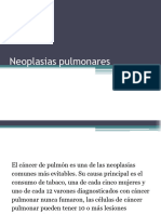 Neoplasias Pulmonares