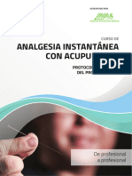 Analgesia Nstantanea Con Acupuntu