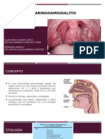 FARINGOAMIGDALITIS