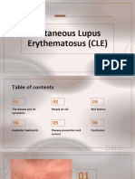 Lupus