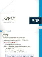 AVNRT (Medicalstudyzone - Com)