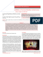 Immediate Direct Rehabilitation of Fractured Maxillary Central Incisors