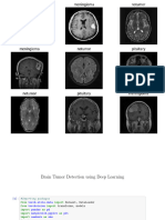 Brain Tumor Detection Using Deep Learning