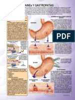 Aines y Gastropatias