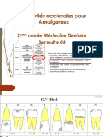 Cavitã©s Occlusales Pour Amalgames2425