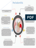 Periodontitis 