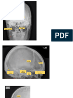 Parcial Radiologia Craneo y Cuello