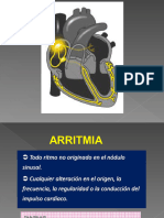 Arritmia 17