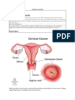 Cervical Cancer