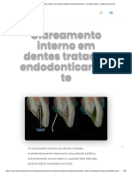 Clareamento Dental Na Endodontia