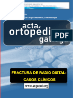 21 AOG 2023 Monograco Fractura Radio Distal