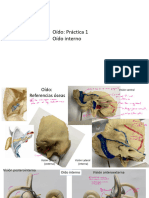 Prácticas 1-2 Oido