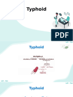 Typhoid