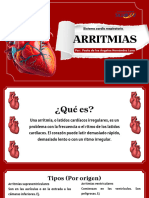 Arritmias