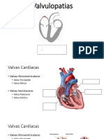 Aula Estacio Valvulopatias
