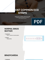 Nine Most Common ECG Strips