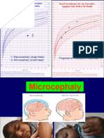 7 - Hydrocephalus-1