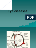 Eye Diseases