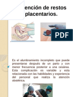 Grupo #4. Complicaciones Del Puerperio