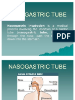 Nasogastric Tube