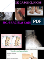 2. ESPONDILOSIS ESPONDILOLISTESIS