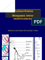 Bradiarrtmias y BR CEM