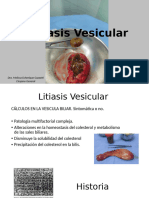 Litiasis Vesicular