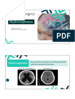 L4 Hydrocephalus Converted