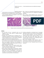 13. ENDOMETRIAL CANCER