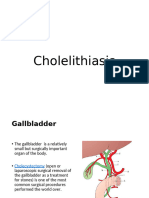 cholelithiasis