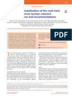 Phacoemulsification of the rock-hard dense nuclear cataract