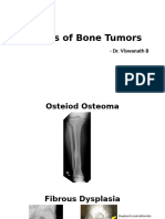 X-Rays of Bone Tumors.pptx - Dr. Viswanath B(1)