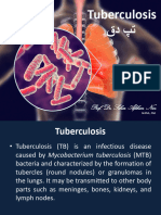 Tuberculosis