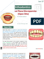 Ortho5 Lec.17 Open Bite