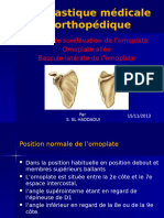 déformations de la ceinture scapulaire