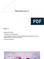 Neoplasias 2