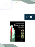 Download Full Planning and Making Crowns and Bridges 4th Edition Bernard G.N. Smith PDF All Chapters