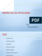 INFARCTUS DU MYOCARDE