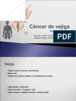 Cáncer de Vejiga