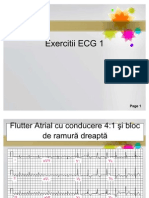 Exercitii Ecg