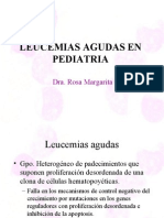 Leucemia Linfoblastica Aguda