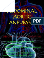 Abdominal Aortic Aneurysm