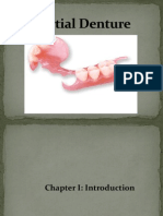 Partial Denture