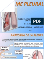 Derrame Pleural