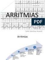 ARRITMIAS