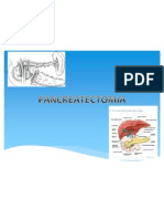 Pancreatectomia