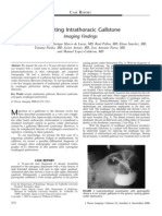 Migrating Intrathoracic Gallstone