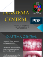 Diastema Central Definitivo 2