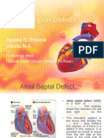 Atrial Septal Defect