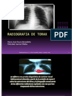 Radiografia de Torax